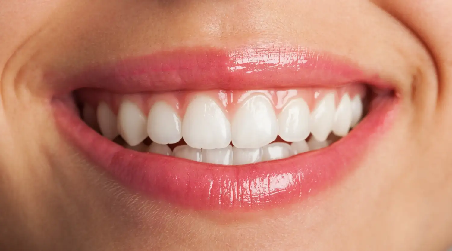 Blanqueamiento dental